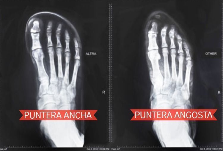 comparación1